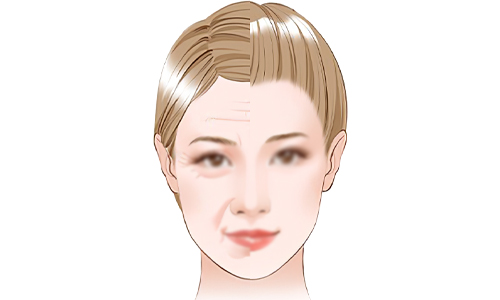 面部抗衰老的意义