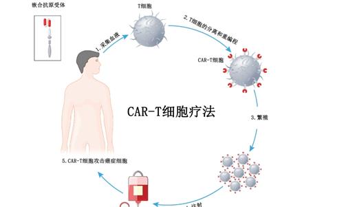 CAR-T细胞疗法原理