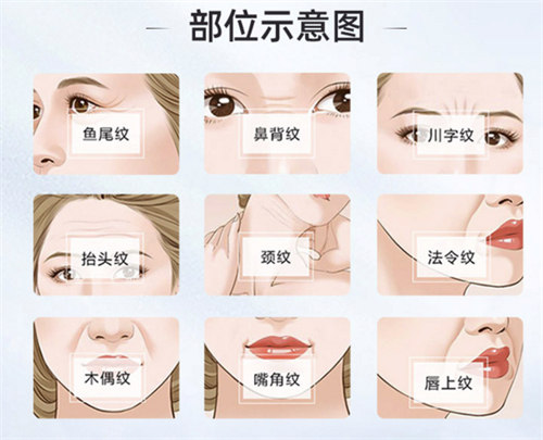 面部除皱部位演示动画图