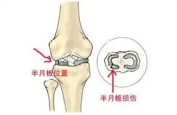 日本注射干细胞治疗骨关节炎怎么样？介绍干细胞治疗骨关节炎的功效和作用，技术、口碑、价格等~