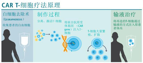 CART细胞疗法治疗原理