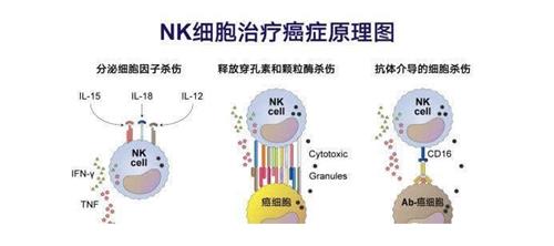 NK细胞疗法治疗
