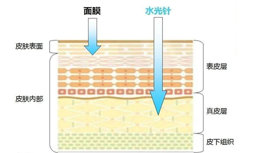 东京新桥虎之门健康诊所水光补水和面膜补水的区别