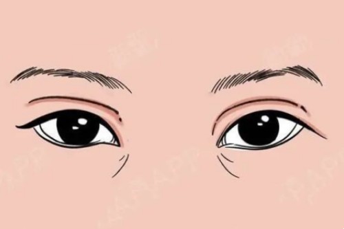 日本东京整形医院哪个好？BIANCA银座院/B-LINE美容整形/新桥虎之门健康诊所/贝尔美容外科/neopolis都在榜内！