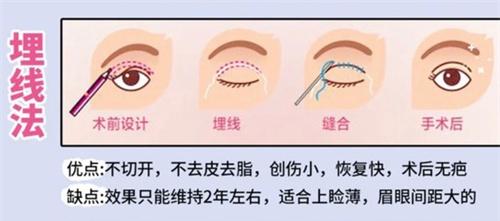 日本BIANCA银座院怎么样？眼鼻整形/皮肤护理/轻颜打造都擅长，是日本有名的美容机构