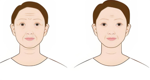 日本贝尔美容外科诊所怎么样？正规美容机构，做眼鼻/除皱/抗衰等项目都擅长收费也不高