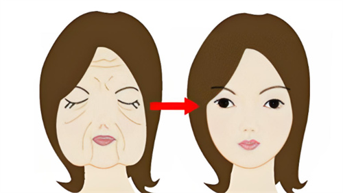 日本贝尔美容外科怎么样?真实体验揭秘自然美背后的硬实力!黄金线抗衰-埋进皮肤里的冻龄密码