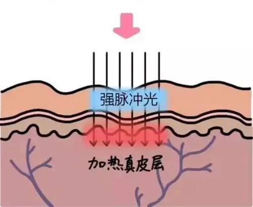 日本LORE诊所内部资料公开，东京新宿区受欢迎医美机构做改善收费不贵体验好！