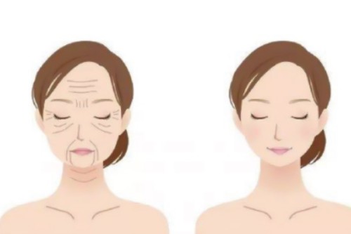 东京北青山D诊所怎么样?预防医疗+抗衰一体,不开刀治顽疾,上班族必看攻略