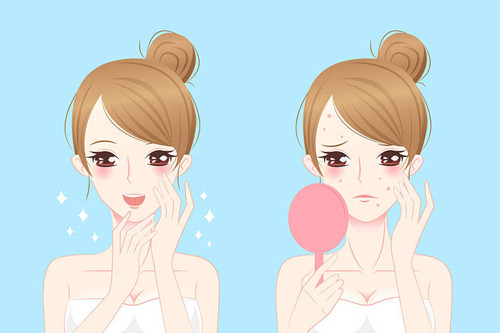 祛痘前后对比卡通示意图