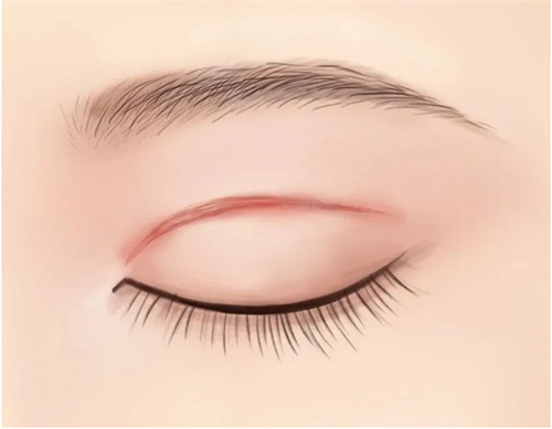 日本Noel诺埃尔银座美容医院怎么样？是日本有名整容医院，整形外科及皮肤科项目做得好！