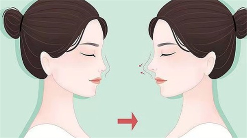 日本让皮肤科整形外科诊所怎么样?在银座和大阪都有分院，做鼻子和丰胸整形手术出名！