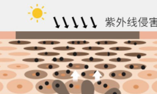 眼部色素沉积形成黑眼圈