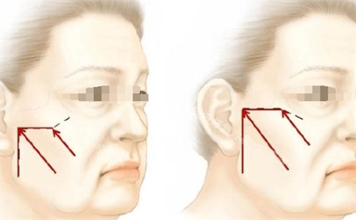 日本让皮肤科整形外科诊所怎么预约？线上线下方式公开，技术扎实口碑赞