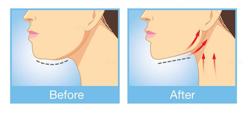 日本中村麻布十番诊所整形预约挂号：电话/官方/三方/到院等均支持，另分享其技术及口碑