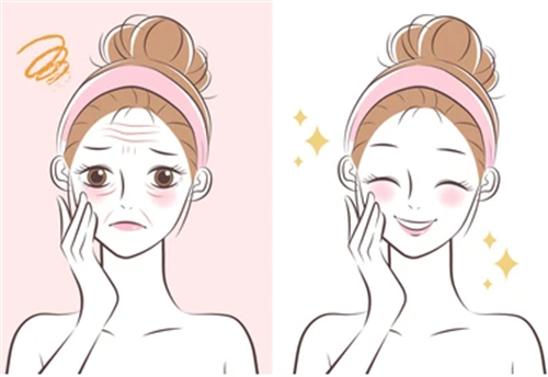 日本整形医院抗衰仪器有哪些?Noel诺埃尔银座皮肤科带你了解热玛吉等热门光电抗衰项目!