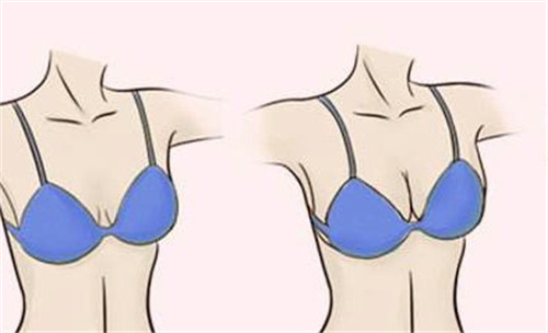 揭秘日本贝尔整形：多样项目、正规团队，带你开启美丽与健康的奇妙之旅！