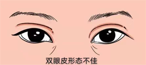 赴日整形靠谱吗？揭秘日本整形优势、缺点及失败原因，为你变漂亮之路把关！