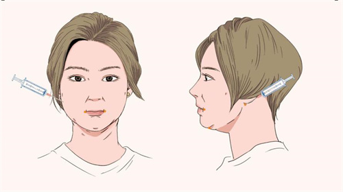 日本诺利斯美容怎么样？亲历者360°深扒，看完再决定要不要飞大阪！