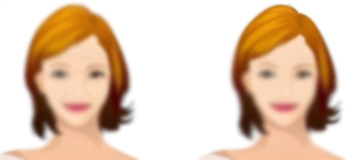 热玛吉前后对比 热玛吉前后对比