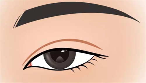 双眼皮形态展示 双眼皮形态展示