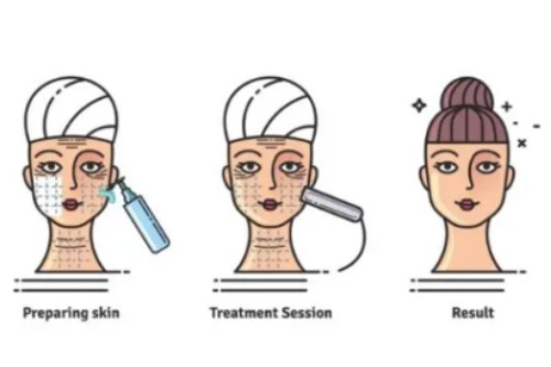 面部做项目卡通图 面部做项目卡通图