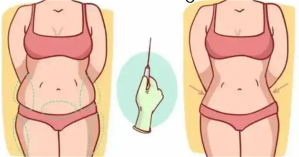 日本Mods整形外科怎么样？吸脂手术超出色！设备可靠+审美在线，规避凹凸不平