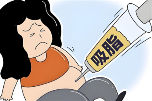 非正规吸脂术 非正规吸脂术