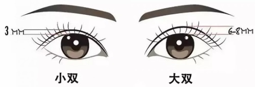 双眼皮宽度示意图 双眼皮宽度示意图