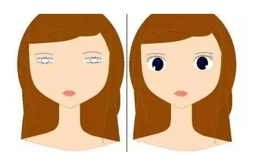 眼皮松弛做双眼皮对比图 眼皮松弛做双眼皮对比图