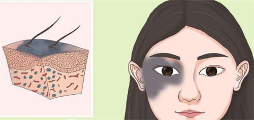 第2西原诊所实力如何？CPC双循环培养体系|体内诱导分化技术|零冷冻运输