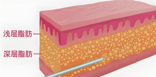 水动力溶脂 水动力溶脂