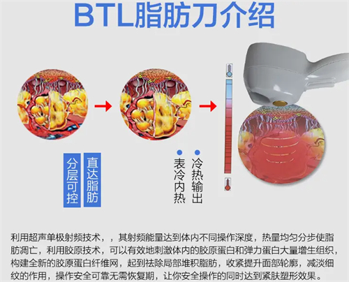 溶脂刀仪器作用图解 溶脂刀仪器作用图解
