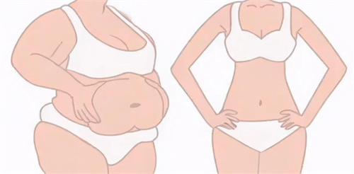 激光溶脂瘦腰腹对比图 激光溶脂瘦腰腹对比图