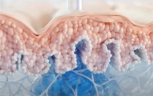 乔雅登HarmonyCA注射