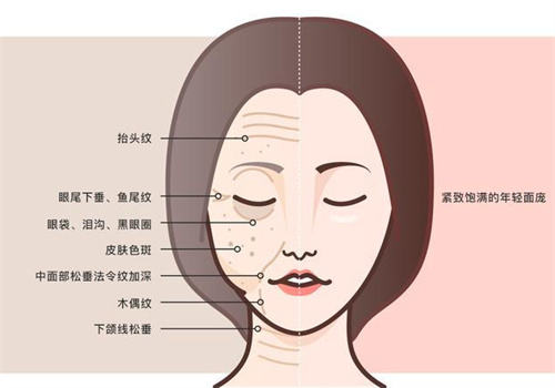 面部抗衰前后 面部抗衰前后