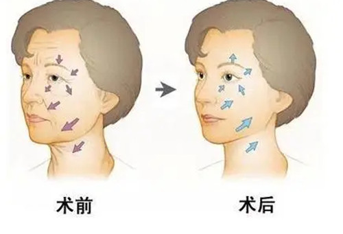 日本贝尔美容外科诊所怎么预约？具体位置&上班时间&预约方式全攻略